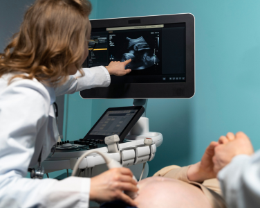Ultrasound 3D/4D